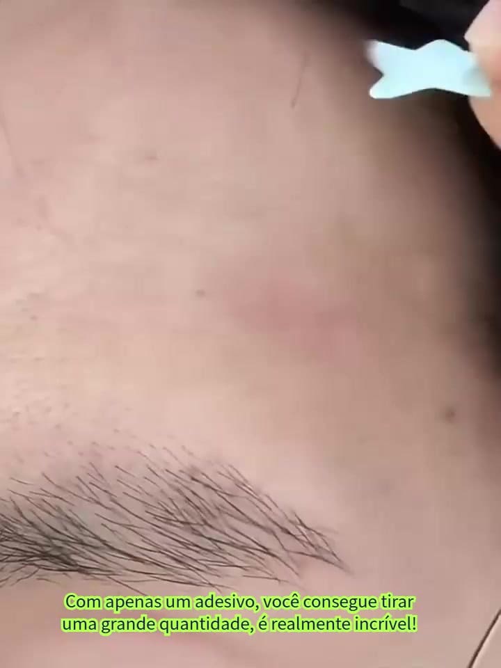 Hidrocolóide Acne Remendos Rosto Espinha Adesivos Para Zits Tratamento De Ponto Cuidados Com A Pele Essencial