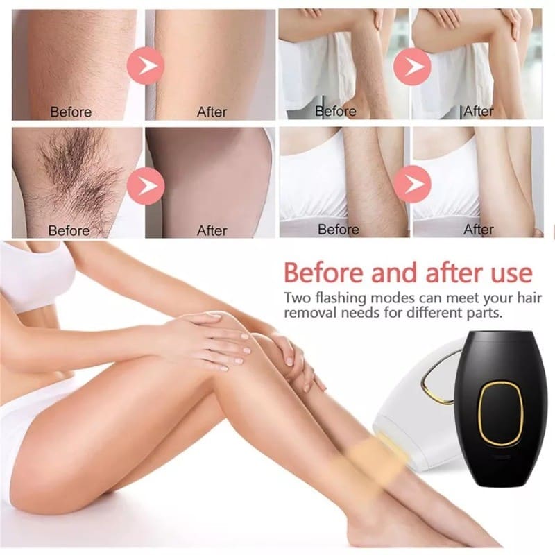 Depilador de Luz Pulsada IPL: Tecnologia Avançada para Remoção de Pelos LIULIU