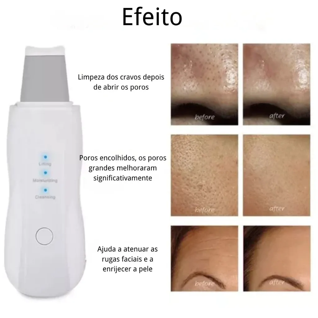 Esfoliante de pele ultrassônico.